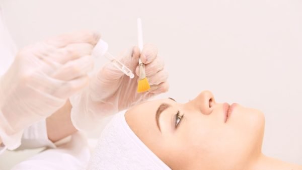 ITEC Chemical Peels